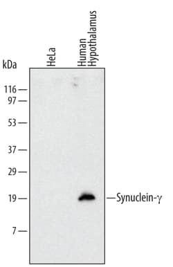 Human gamma-Synuclein Antibody, R D Systems 100ug; Unlabeled:Antibodies,