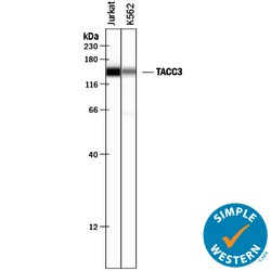 Human TACC3 Antibody, R D Systems 100&mu;g; Unlabeled:Antibodies, Polyclonal