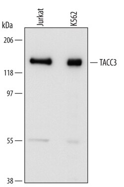 Human TACC3 Antibody, R D Systems 100&mu;g; Unlabeled:Antibodies, Polyclonal