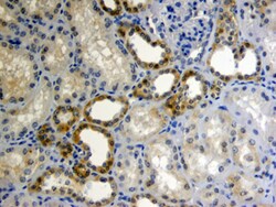 Human TACE/ADAM17 Cytosolic Domain Antibody, R D Systems 100&mu;g; Unlabeled:Antibodies,