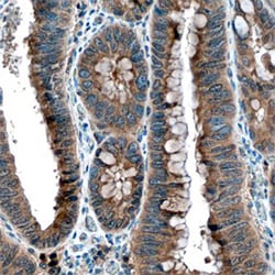 Human TACE/ADAM17 Antibody, R D Systems 25&mu;g; Unlabeled:Antibodies,