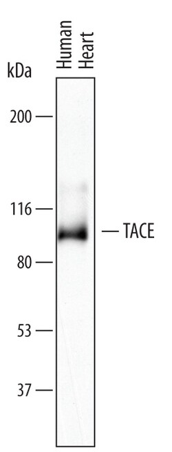 Human TACE/ADAM17 Antibody, R D Systems 25&mu;g; Unlabeled:Antibodies,