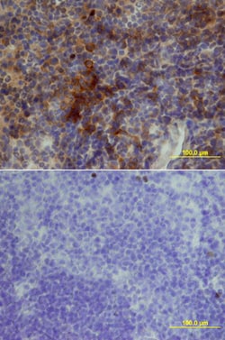 Mouse TACI/TNFRSF13B Biotinylated Antibody, R D Systems 50&mu;g; Biotin:Antibodies,