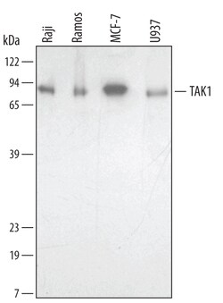 Human TAK1 Antibody, R D Systems 25&mu;g; Unlabeled:Antibodies, Monoclonal