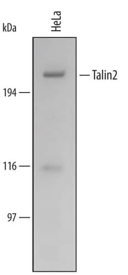 Human Talin2 Antibody, R D Systems 25&mu;g; Unlabeled:Antibodies, Polyclonal