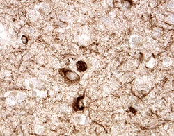 Tau Antibody, R D Systems 25&mu;g; Unlabeled:Antibodies, Polyclonal