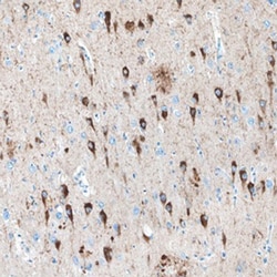 Human Tau MAb (Clone 376720), R D Systems 25&mu;g; Unlabeled:Antibodies,