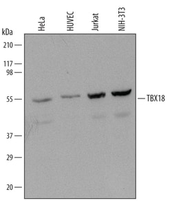 Human TBX18 Antibody, R D Systems 25&mu;g; Unlabeled:Antibodies, Monoclonal