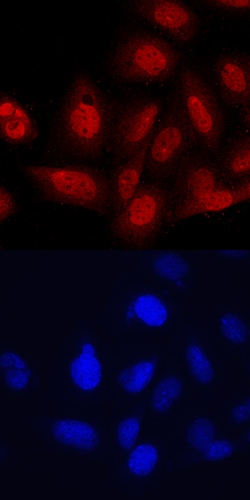 Human TBX18 Antibody, R D Systems 100ug; Unlabeled:Antibodies, Monoclonal