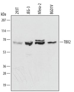 Human TBX2 Antibody, R D Systems 25&mu;g; Unlabeled:Antibodies, Monoclonal