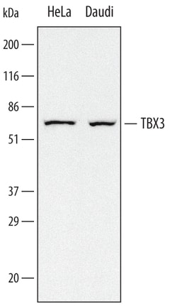 Human TBX3 Antibody, R D Systems 100&mu;g; Unlabeled:Antibodies, Polyclonal