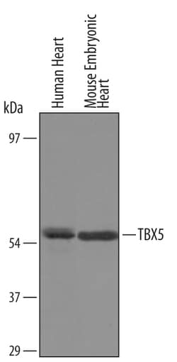 Human/Mouse TBX5 Antibody, R D Systems 25&mu;g; Unlabeled:Antibodies, Polyclonal
