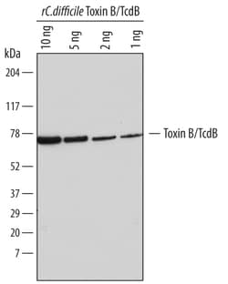 C. difficile Toxin B/TcdB Antibody, R D Systems 100&mu;g; Unlabeled:Antikörper