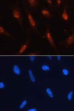 Human TCF-3/E2A Antibody, R D Systems 25&mu;g; Unlabeled:Antibodies, Monoclonal