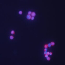 Human TCL1A Antibody, R D Systems 100&mu;g; Unlabeled:Antibodies, Polyclonal
