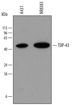 Human/Mouse/Rat TDP-43/TARDBP Antibody, R D Systems 25&mu;g; Unlabeled:Antibodies,