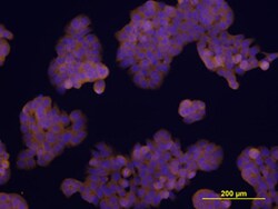 Human TEM8/ANTXR1 Isoform 1 Antibody, R D Systems 100&mu;g; Unlabeled:Antibodies,