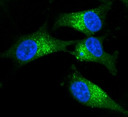 Human Tenascin C Antibody, R D Systems 100&mu;g; Unlabeled:Antibodies,
