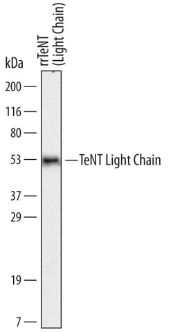 C. tetani TeNT Light Chain Antibody, R D Systems 100ug; Unlabeled:Antibodies,