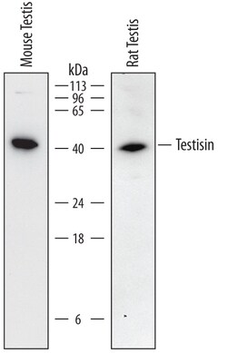 Mouse/Rat Testisin/Prss21 Antibody, R D Systems 100 &mu;g | Buy Online | R&D Systems | Fisher Scientific
