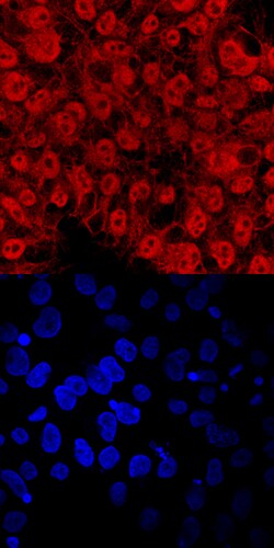 Human TEX19 Antibody, R D Systems 100&mu;g; Unlabeled:Antibodies, Polyclonal