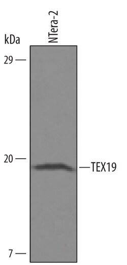 Human TEX19 Antibody, R D Systems 100&mu;g; Unlabeled:Antibodies, Polyclonal