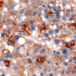 Human TfR (Transferrin R) Antibody, R D Systems 25&mu;g; Unlabeled:Antibodies,