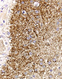 Human TGF-alpha Antibody, R D Systems 100&mu;g; Unlabeled:Antibodies, Polyclonal