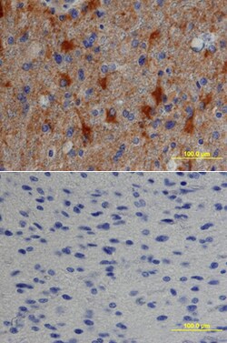 Human TGF-alpha Antibody, R D Systems 100&mu;g; Unlabeled:Antibodies, Polyclonal