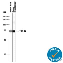 TGF-beta 2 Antibody, R D Systems 1mg; Unlabeled:Antibodies, Polyclonal