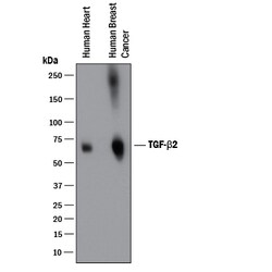 TGF-beta 2 Antibody, R D Systems 1mg; Unlabeled:Antibodies, Polyclonal