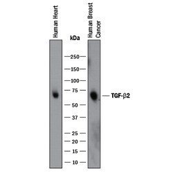TGF-beta 2 Antibody, R D Systems 1mg; Unlabeled:Antibodies, Polyclonal
