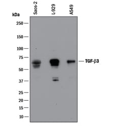 TGF-beta 3 Antibody, R D Systems 100 &mu;g | Buy Online | R&D Systems | Fisher Scientific