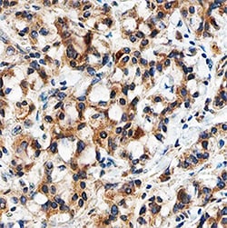 TGF-beta 3 Antibody, R D Systems:Antibodies:Primary Antibodies