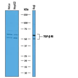 Human TGF-beta RI/ALK-5 Antibody, R D Systems 25&mu;g; Unlabeled:Antibodies,