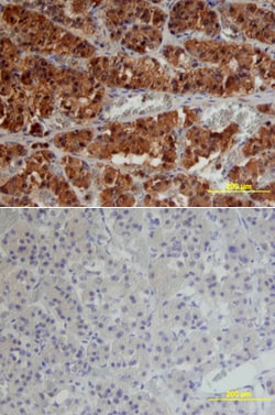 Human TGF-beta RII Antibody, R D Systems 25&mu;g; Unlabeled:Antibodies,