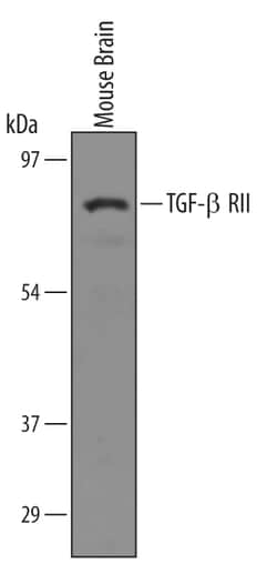 Mouse TGF-beta RII Antibody, R D Systems 100&mu;g; Unlabeled:Antibodies,