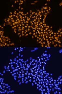 Human/Mouse THAP11 Antibody, R D Systems 100ug; Unlabeled:Antibodies, Monoclonal
