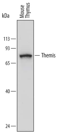 Mouse Themis Antibody, R D Systems 100 &mu;g | Buy Online | R&D Systems | Fisher Scientific