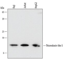 Human Thioredoxin-like 5/TRP14 Antibody, R D Systems 100ug; Unlabeled:Antibodies,