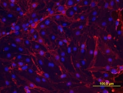 Mouse Thrombomodulin/BDCA-3 Antibody, R D Systems 100ug; Unlabeled:Antibodies,