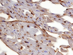 Mouse Thrombomodulin/BDCA-3 Antibody, R D Systems 100ug; Unlabeled:Antibodies,