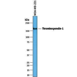Human Thrombospondin-1 Antibody, R D Systems 100 &mu;g | Buy Online | R&D Systems | Fisher Scientific