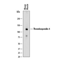 Mouse Thrombospondin-4 Antibody, R D Systems Unlabeled; 100&mu;g:Antibodies,