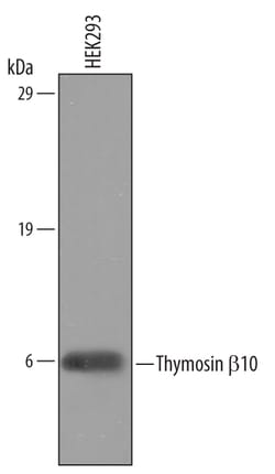 Human/Mouse/Rat Thymosin beta 10 Antibody, R D Systems 100&mu;g; Unlabeled:Antibodies,