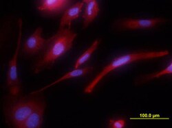 Human Tie-1 Antibody, R D Systems 500ug; Unlabeled:Antibodies, Monoclonal