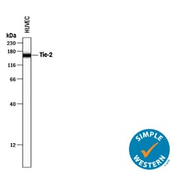 Human Tie-2 Antibody, R D Systems 25&mu;g; Unlabeled:Antibodies, Polyclonal