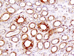 Human TIM-1/KIM-1/HAVCR Antibody, R D Systems:Antibodies:Primary Antibodies