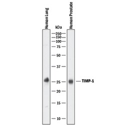 Human TIMP-1 Antibody, R D Systems 100&mu;g; Unlabeled:Antibodies, Polyclonal