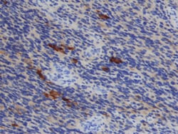 Human TIMP-1 Antibody, R D Systems 100&mu;g; Unlabeled:Antibodies, Monoclonal